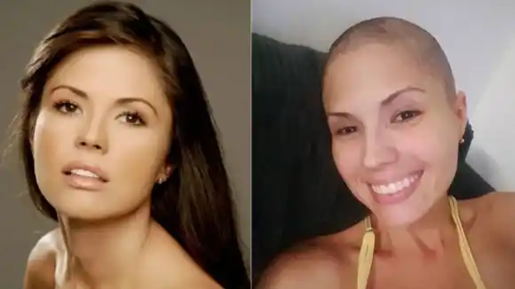 Actriz  Carmen Alicia Lara comenzó tratamientos contra el cáncer