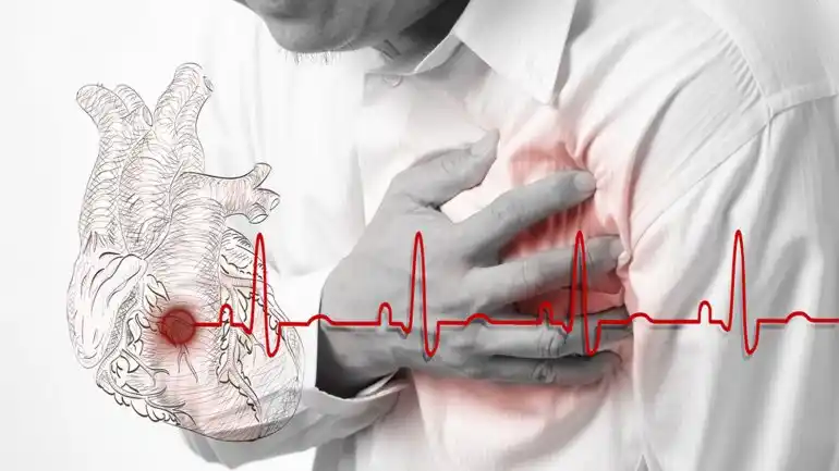 “Tres de cada cuatro infartos se pueden evitar”