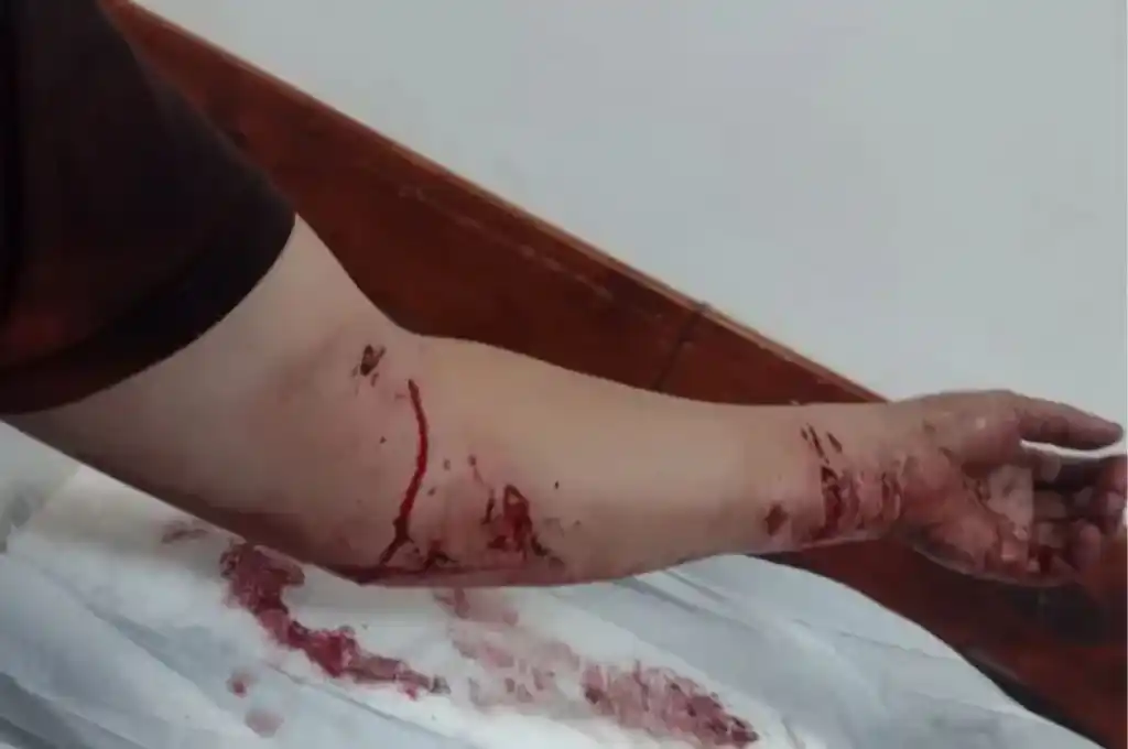 Sufrieron profundas heridas