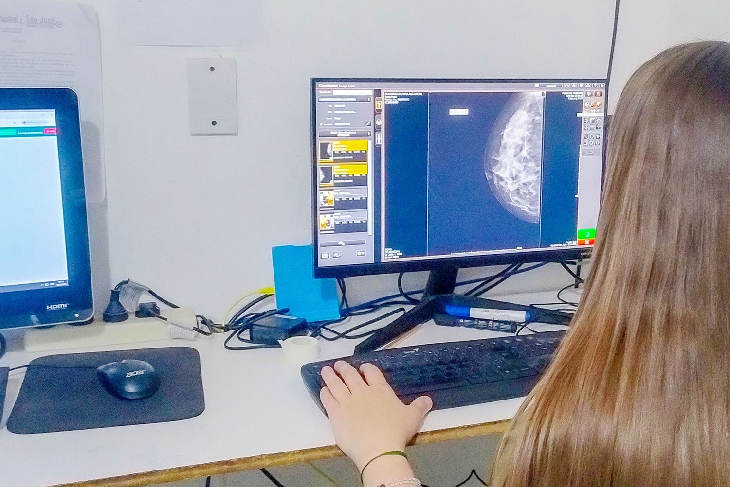 Hospitales de Diamante y Victoria ya cuentan con el sistema PACS para imágenes digitales
