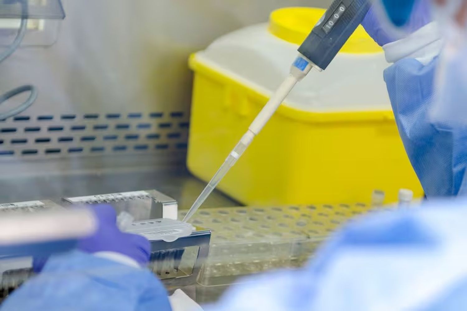 El Instituto Malbrán confirmó el resultado positivo de Mpox.
