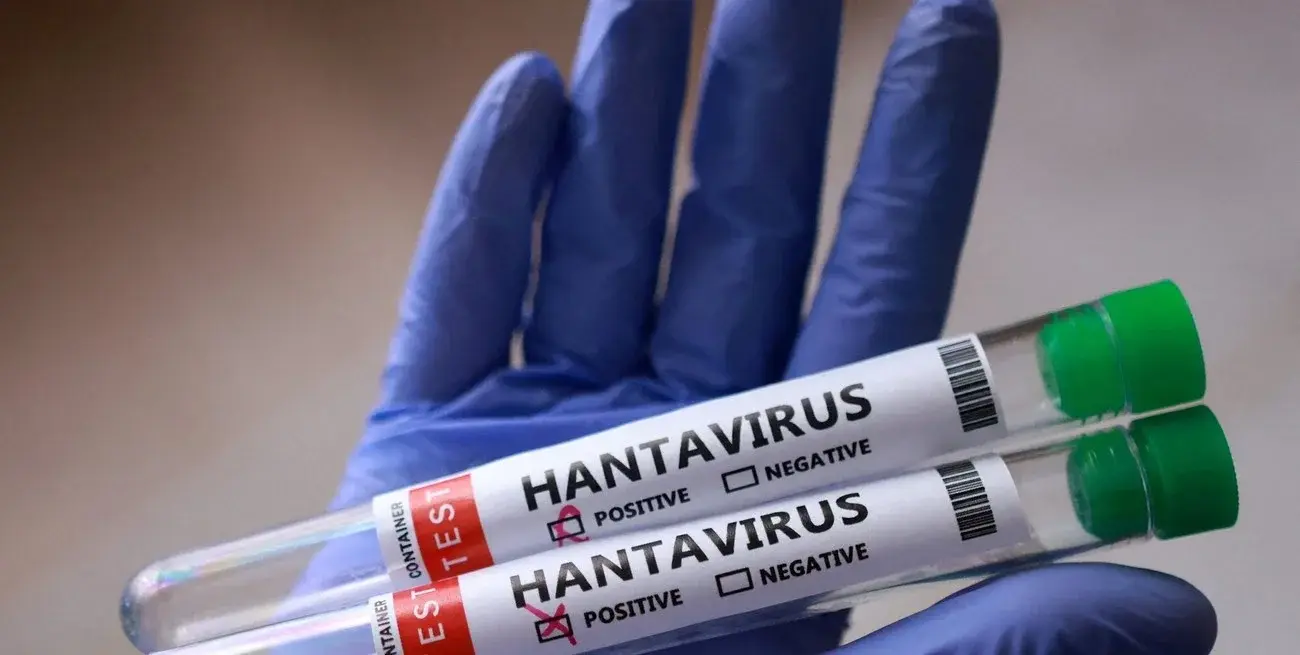 Hantavirus en Santa Fe: confirmaron el primer caso de 2026