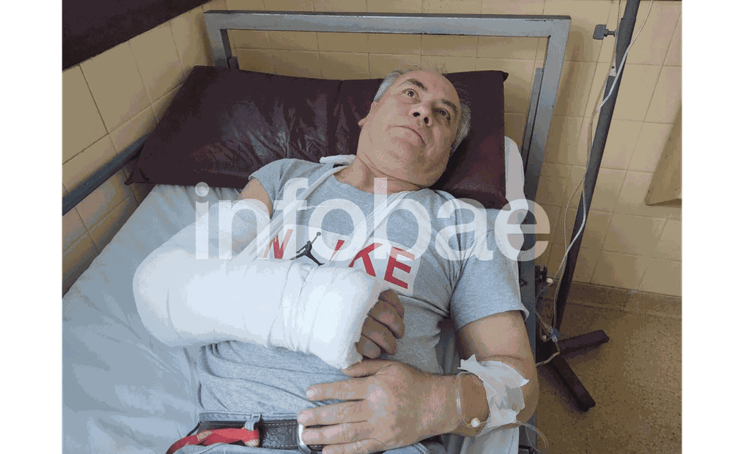Infobae tuvo acceso al fotógrafo que resultó herido en un incidente con Margot Robbie y Cara Delevingne. Foto Infobae. 