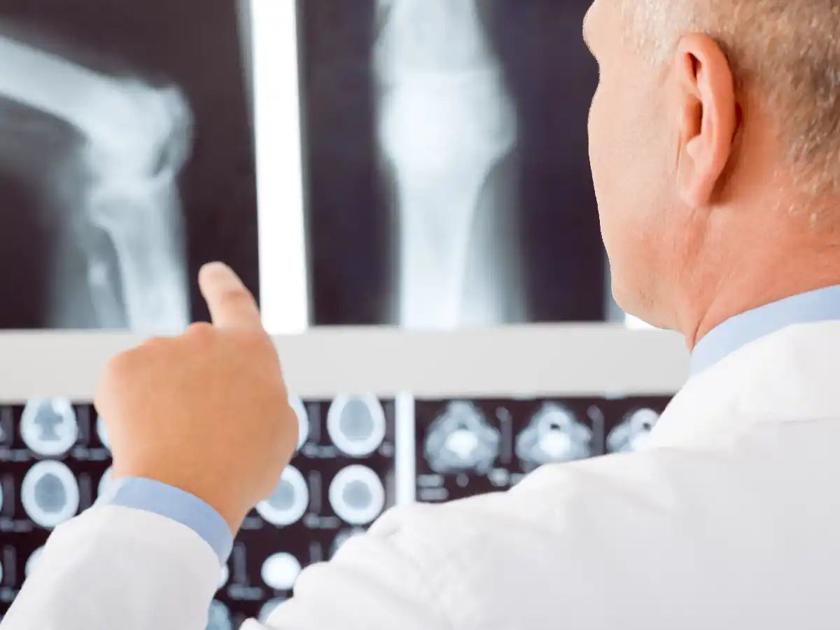 Reumatología: tratamiento y prevención de la osteoporosis