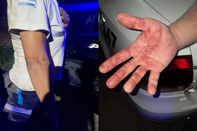 Imputaron a tres hombres que golpearon a inspectores municipales en barrio Tango durante una fiesta clandestina.