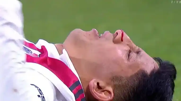 Fuerte lesión en el superclásico: Aliendro se perdería el resto del campeonato