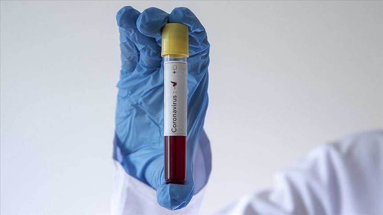 Entre Ríos: Salud informó que descartaron 14 casos sospechosos de Coronavirus
