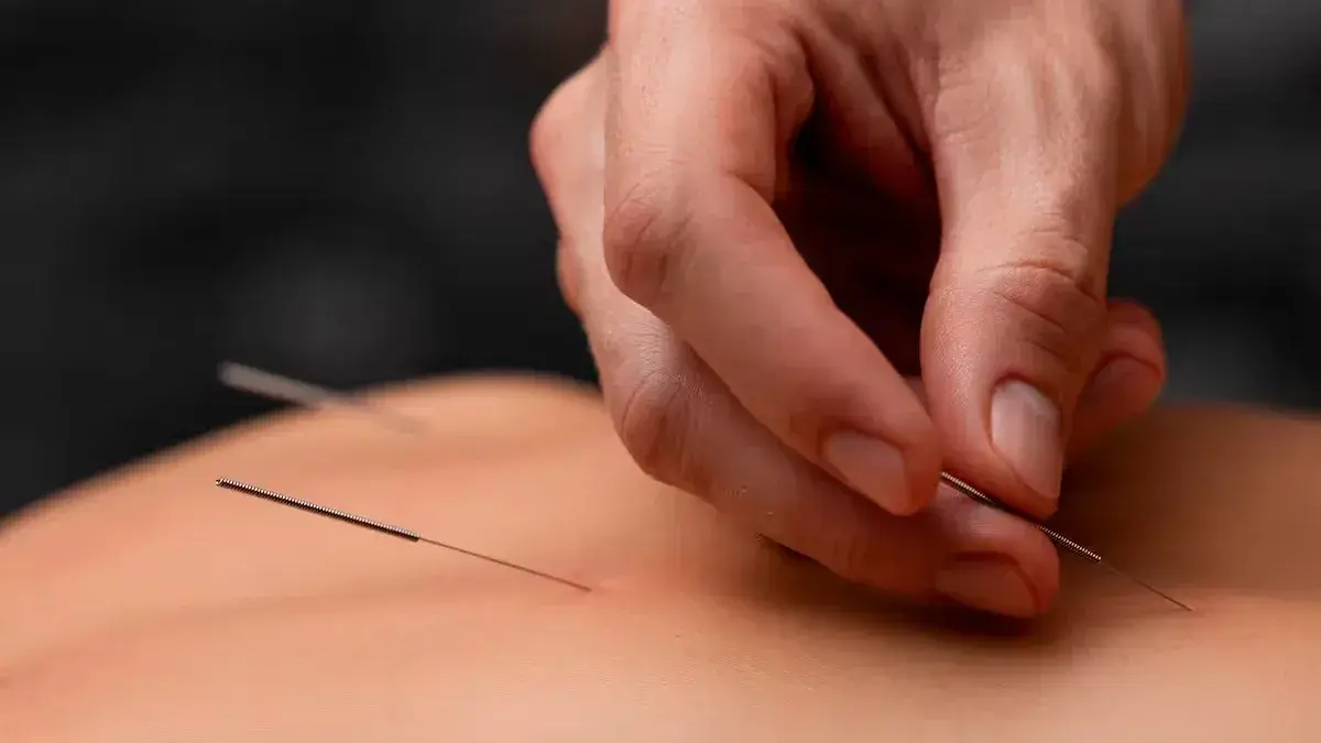 Beneficios de la acupuntura para la recuperación de lesiones