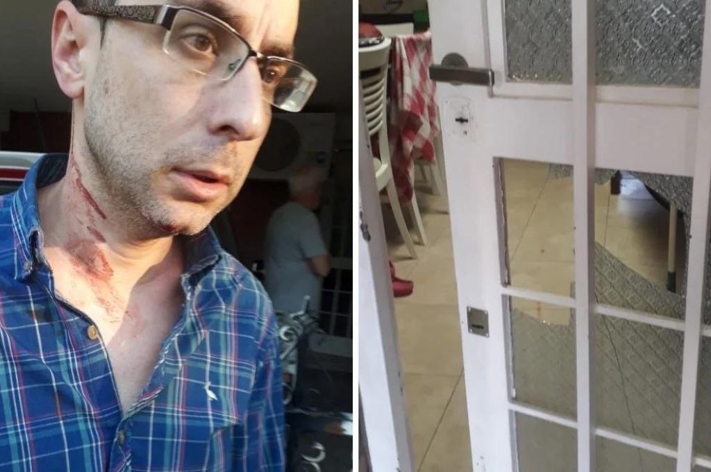 “Esperaba el disparo”: el relato de un hombre, víctima de un dramático asalto en Santa Fe