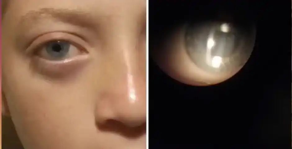 Su hijo perdió la visión de un ojo por un gomerazo, pide colaboración para comprar anteojos para que vuelva a ver