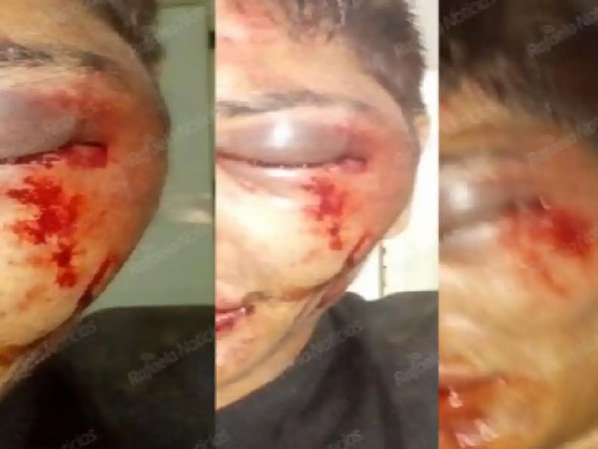  Frontera: vecinos le dieron una brutal golpiza a un ladrón 