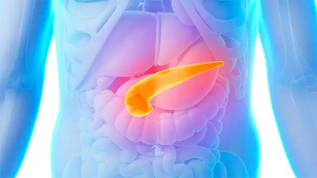 Buscan a pacientes que padecen una rara enfermedad genética