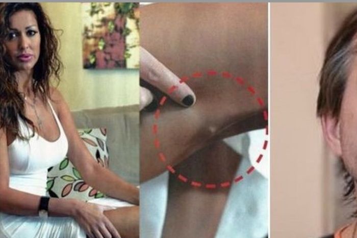 Pamela Sosa, ex pareja del cirujano, dijo que Lotocki era un enfermo psicópata y narcisista