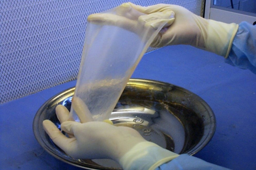 La placenta es un tejido que se desarrolla en el útero durante el embarazo