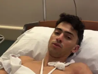 El influencer que perdió dos dedos en un accidente respondió a las críticas