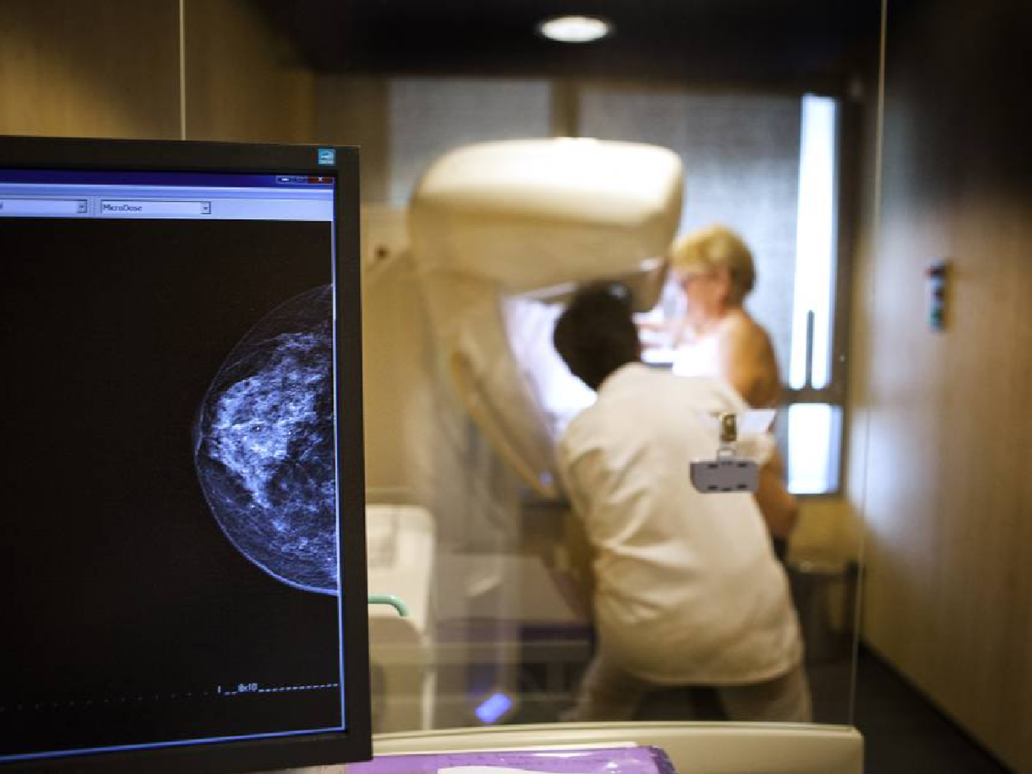 Científicos argentinos descubren que método diagnóstico de cáncer de mama sirve en otros tumores
