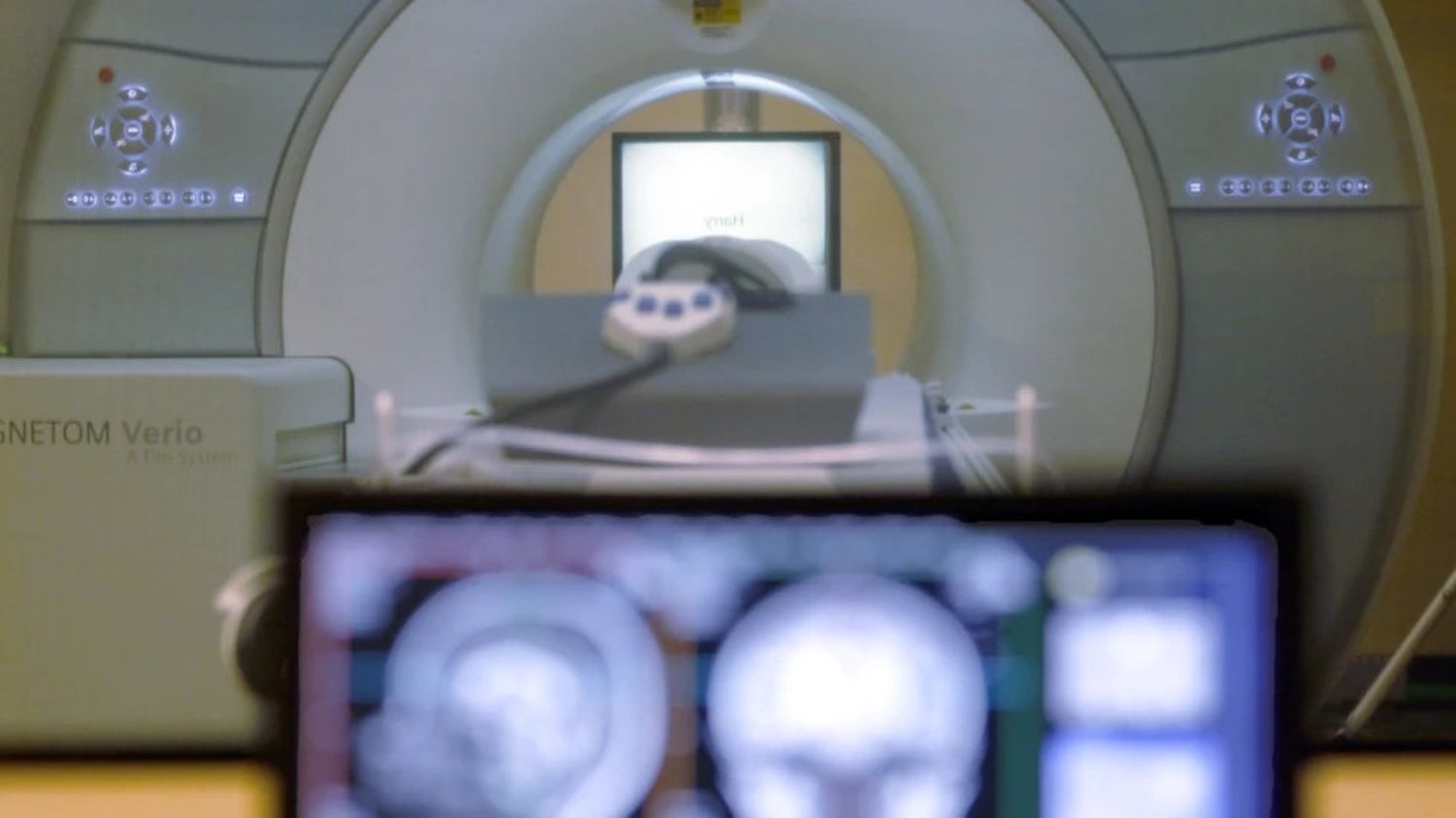 Una máquina de resonancia magnética cerebral se ve en Pittsburgh, el 26 de noviembre de 2014. (Foto AP/Keith Srakocic, Archivo)