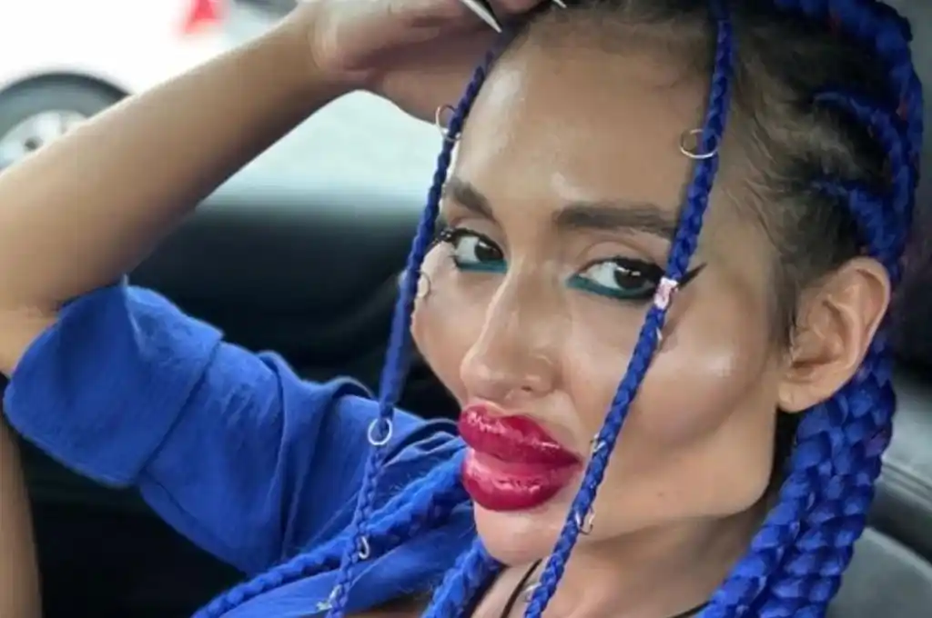 Preocupa la adicción de la modelo por las cirugías