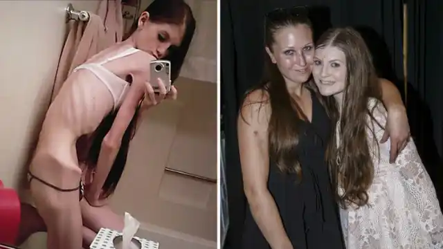 Macabra carrera entre dos hermanas para perder peso