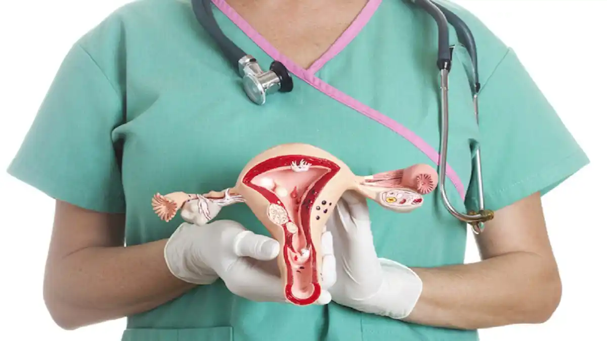 MIOMAS ¿Qué son y cómo se tratan?