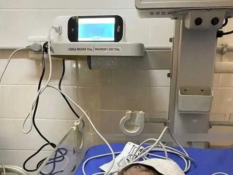 Equipos de última generación fueron 
instalados en el Hospital Distrital de Ibarreta