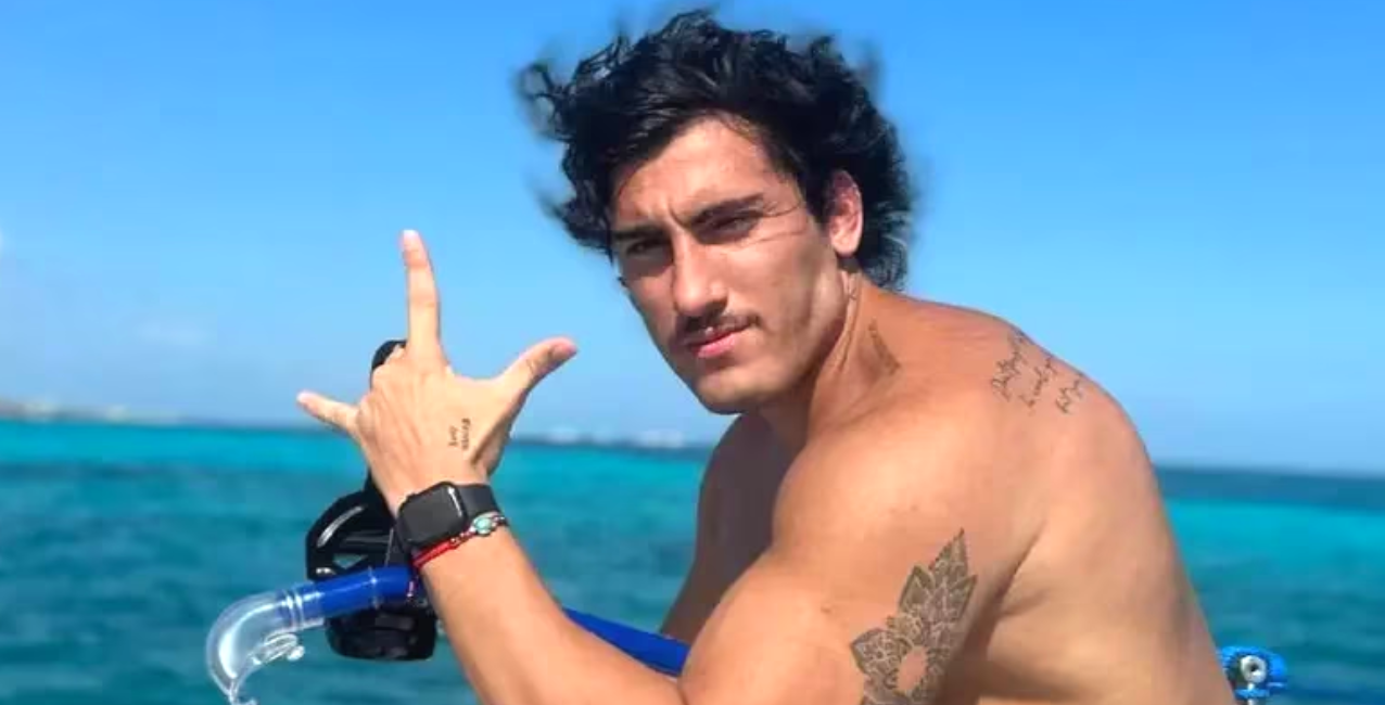 Tomas Holder se operó la cara y compartió el resultado en sus redes: “Un cambio lindo y fino”