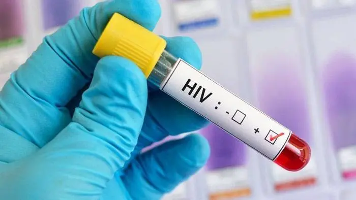 La vacuna de Janssen para el VIH solo confiere una protección del 25%