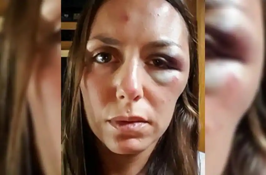 Atacan brutalmente a una rosarina en Ecuador