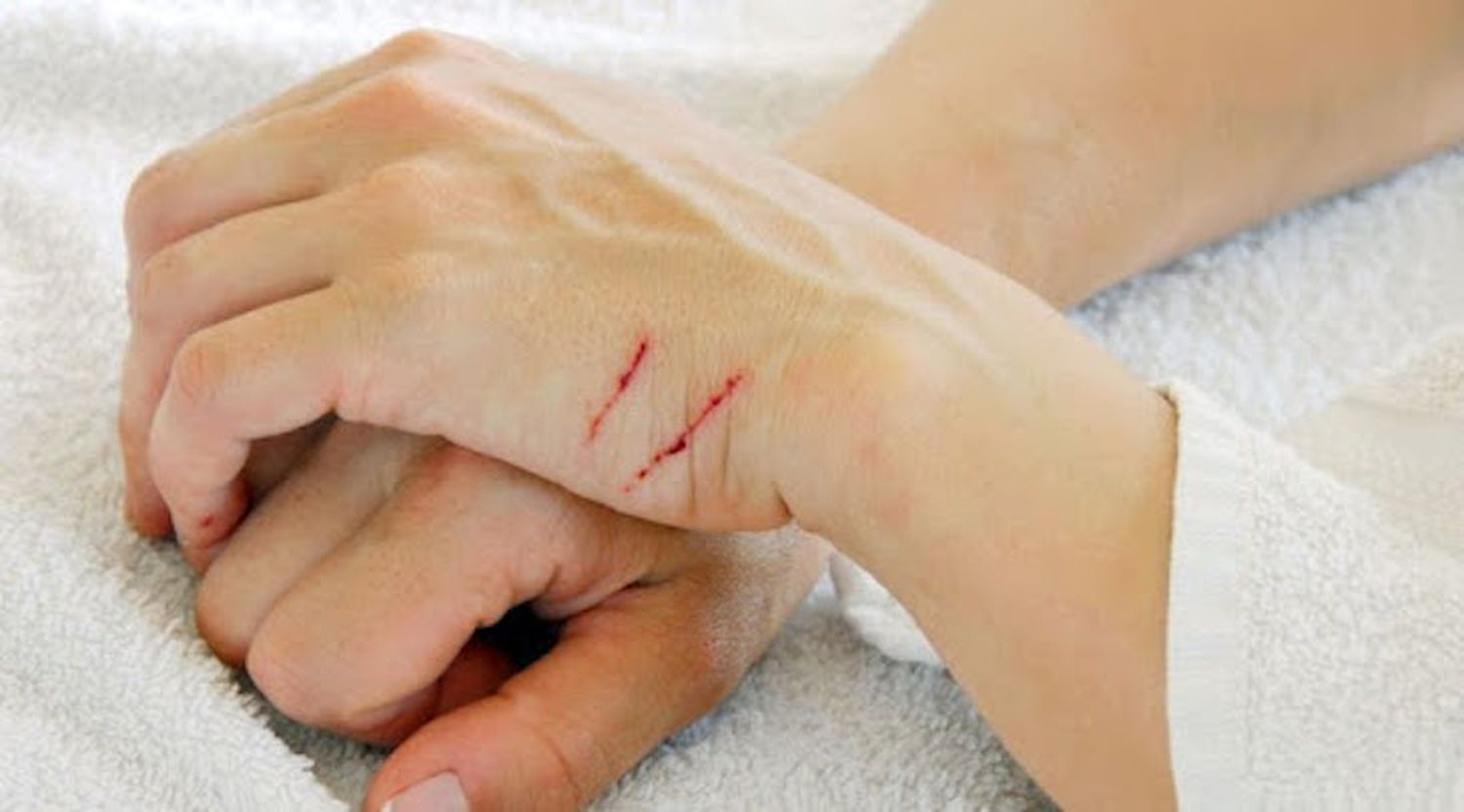 El Hospital Posadas estudió los arañazos de gato ¿Qué enfermedades puede traer?