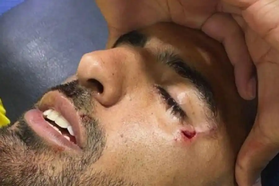 El descargo del jugador de Peñarol agredido en el Gigante de Arroyito: “¡Una vergüenza!”