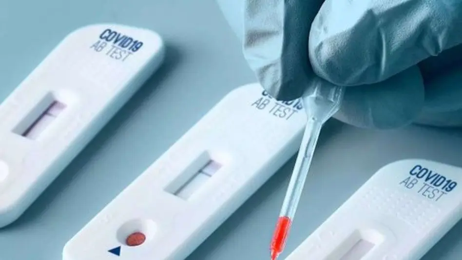Establecieron los mecanismos de notificación del autotest de coronavirus