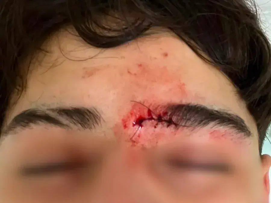 Uno de los adolescentes sufrió un profundo corte en el rostro.