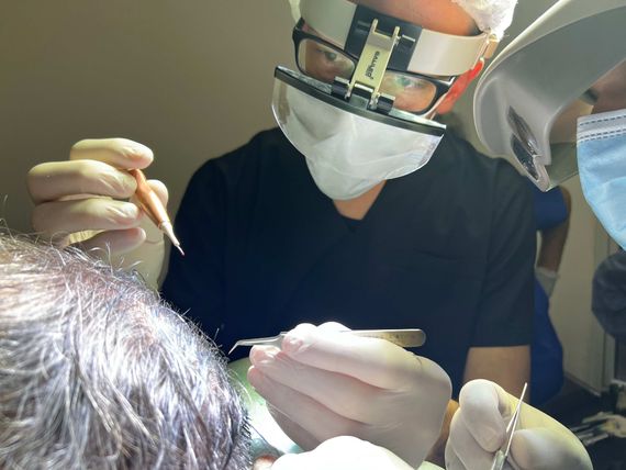 Medicina capilar y cirugía pelo por pelo