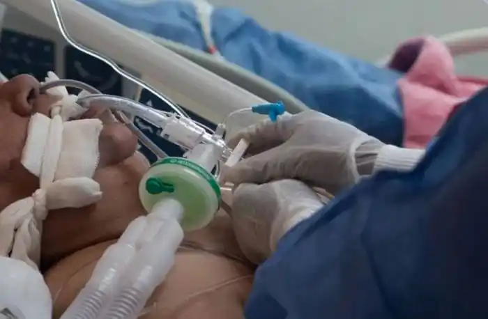 Está ocupado el 78,73 % de las camas de Terapia Intensiva 