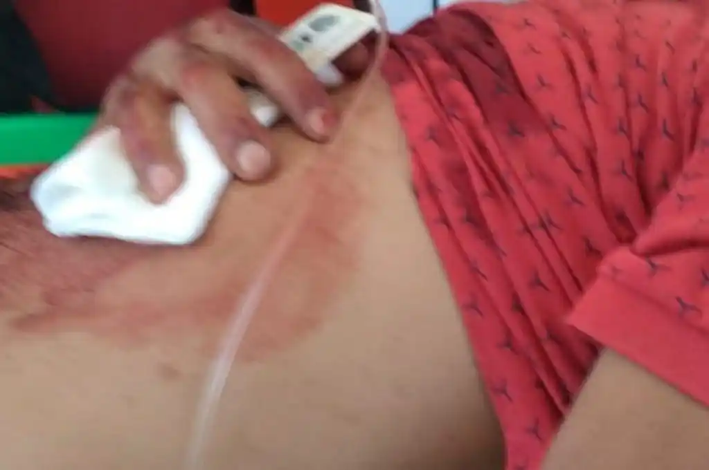 Ocurrió en barrio José Hernández, de la ciudad de San Lorenzo