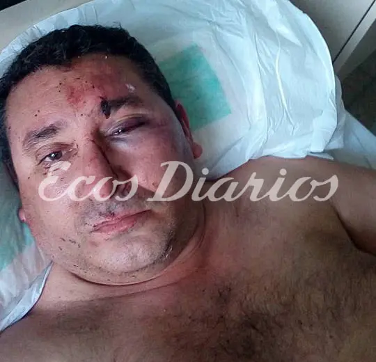 Feroz agresión a un remisero