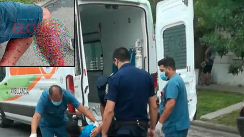 Un hombre fue hospitalizado tras ser agredido a machetazos