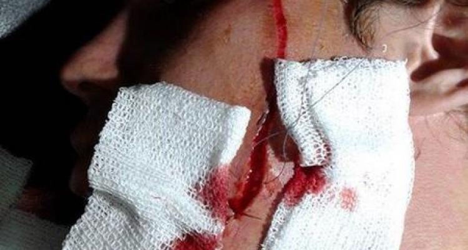 Indignación por salvaje agresión a un menor de 15 años
