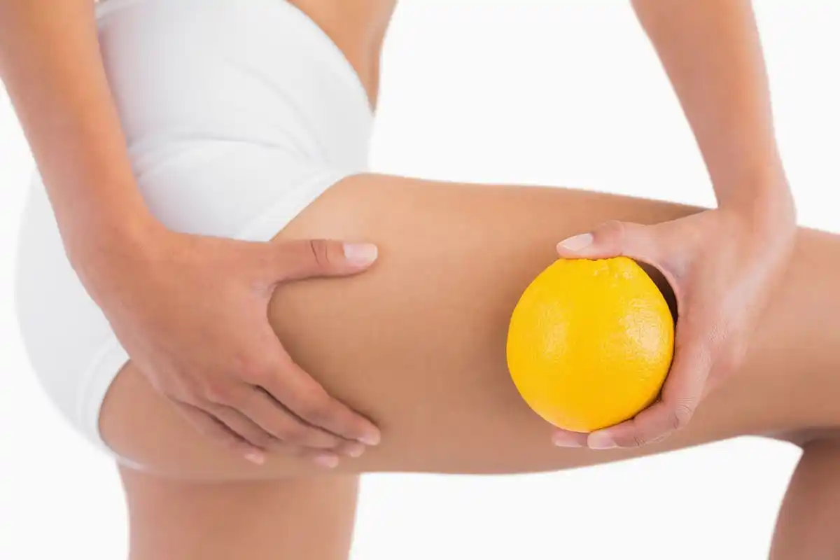 Celulitis: La tan temible piel de naranja y cómo combatirla