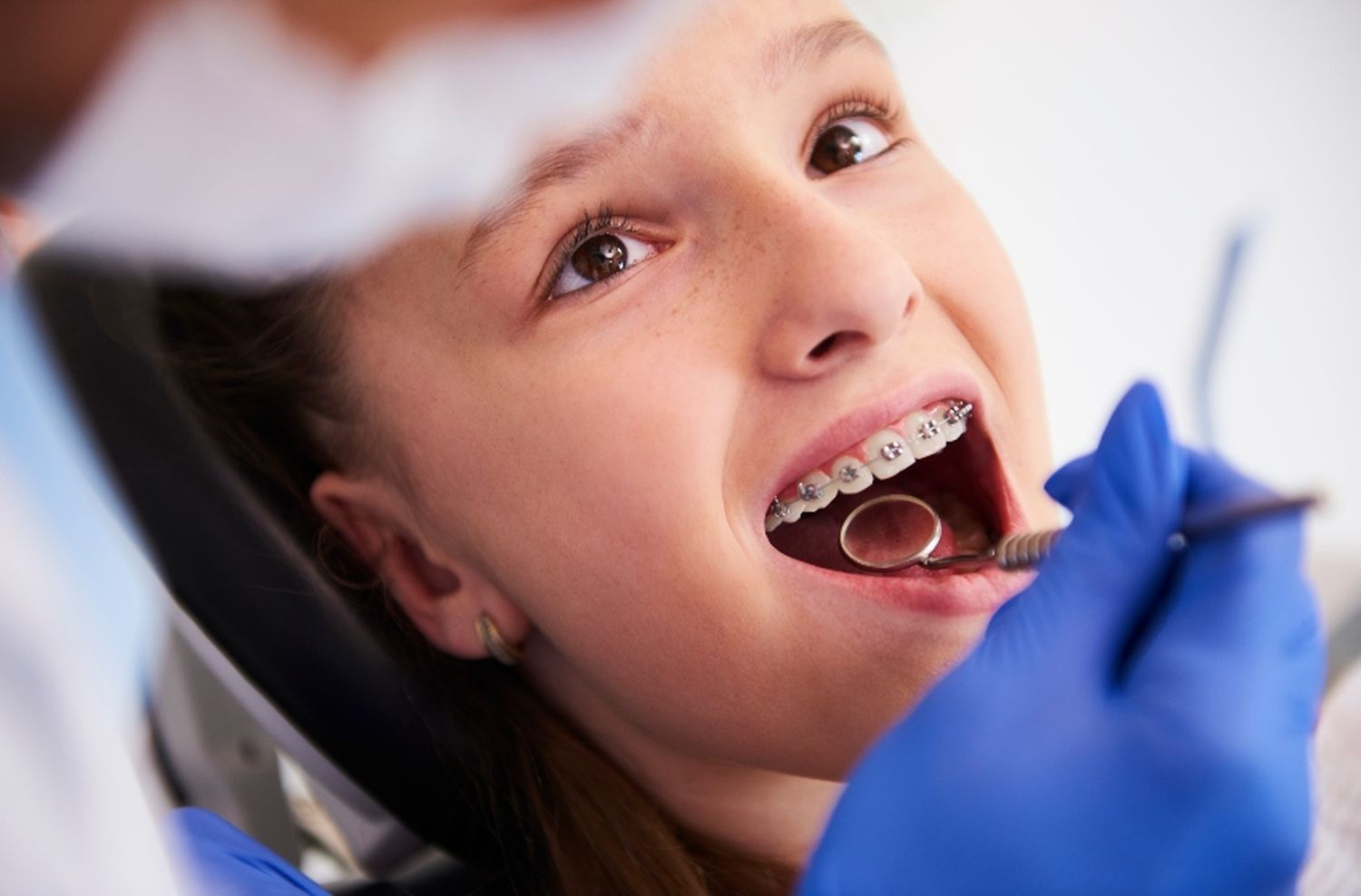 ¿Sabés cuáles son los mejores brakets para vos?