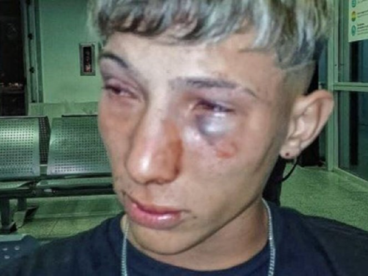 Violenta agresión en un boliche de Santa Fe: un grupo de patovicas le dio una brutal golpiza a un joven