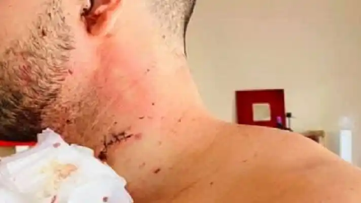 QUERÍAN QUITARLE UNA BOLSA DE COMIDA y le cortaron el cuello: se salvó de milagro