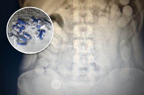 Le encontraron cápsulas con cocaína en el bolso y “se quebró”: confesó que ingirió varias dosis