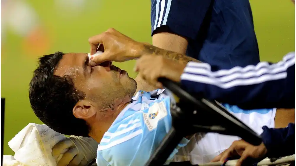 Tevez sufrió una pequeña fisura por el golpe en la nariz