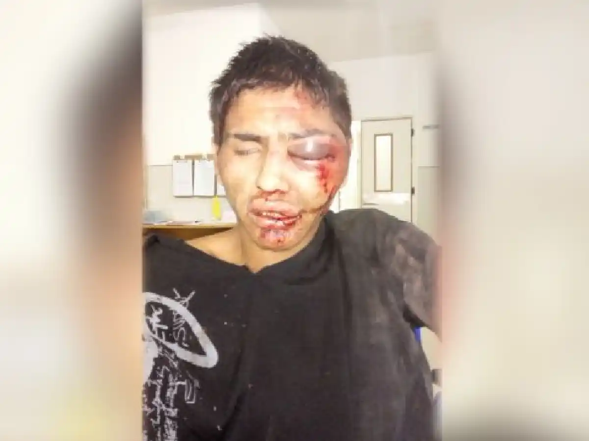 Vuelven a detener a joven que intentó robar celular y fue golpeado por vecinos 