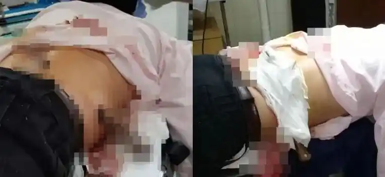 Un entrerriano cayó de su caballo y se clavó el facón en la espalda