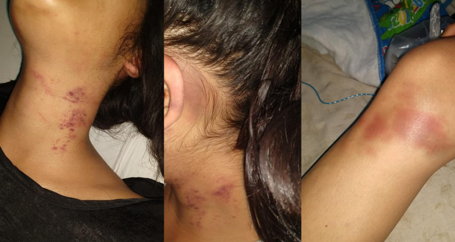 Una joven denunció que fue salvajemente golpeada por su novio “por cómo fue vestida al boliche”