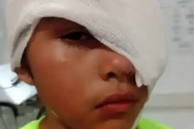 Horror en Barrio Los Hornos: una nena de 8 años fue gravemente herida por un pitbull