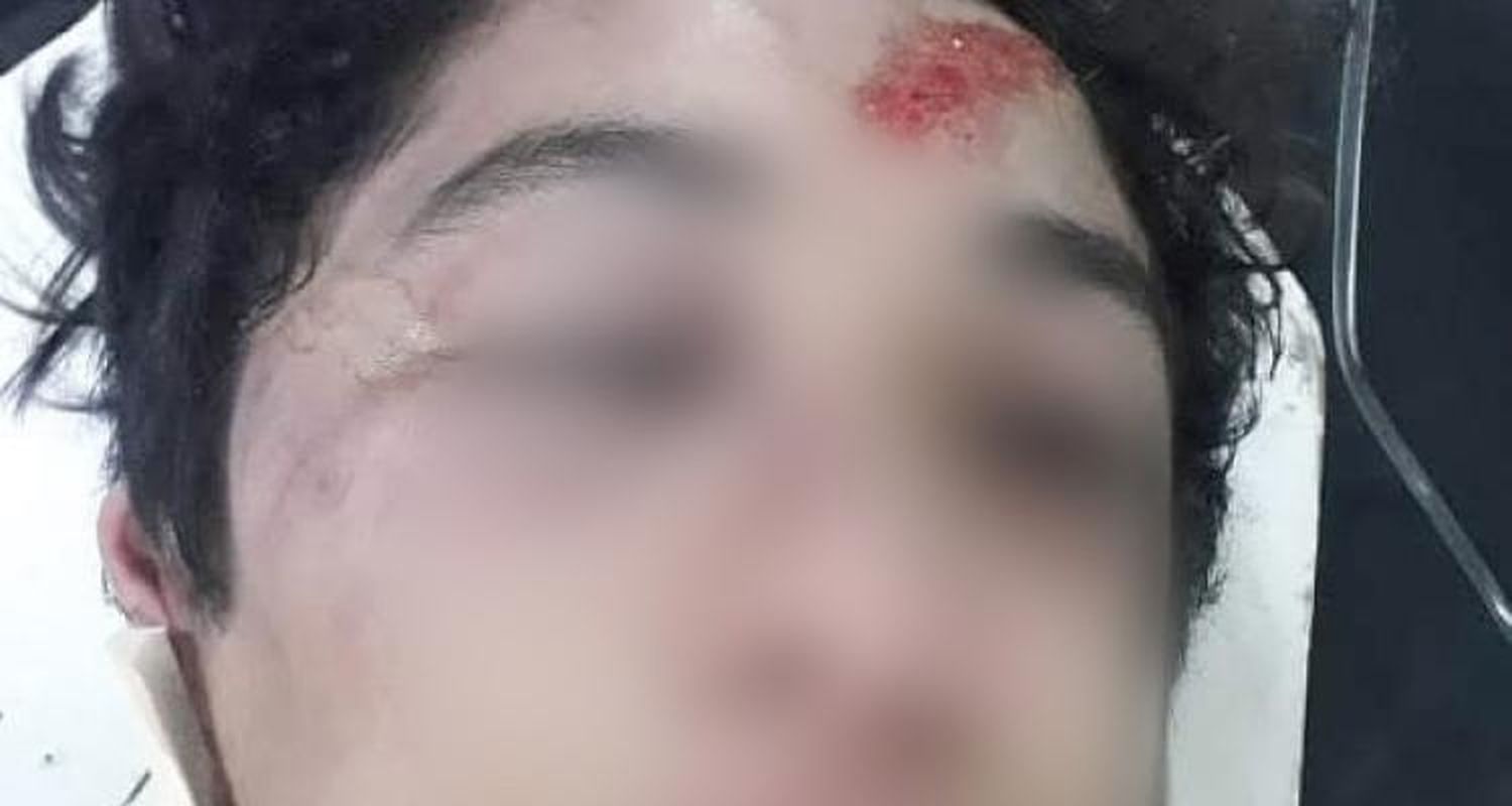 Brutal golpiza a un adolescente de 14 años