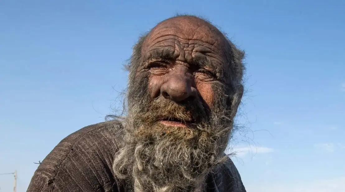 Murió el “hombre más sucio del mundo”, luego de haberse bañado por primera vez en 50 años